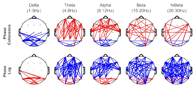 Visualisation de la connectivité qEEG