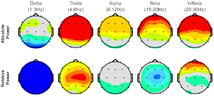 Visualisation de la puissance spectrale qEEG